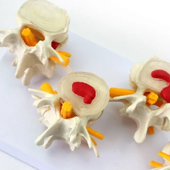 Den Menneskelige Anatomi Skelet Rygsøjlen 4-Stadier I Columna Vertebrale Model Hjernen, Kraniet Traumatisk Undervisning Forsyninger