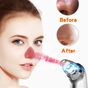 Farve Lys Fem Gear Hudorm Vakuum Maskine Ansigt Rense Pore Acne Bums Fjernelse Vakuumsug Facial Hud Pleje Af 40#715
